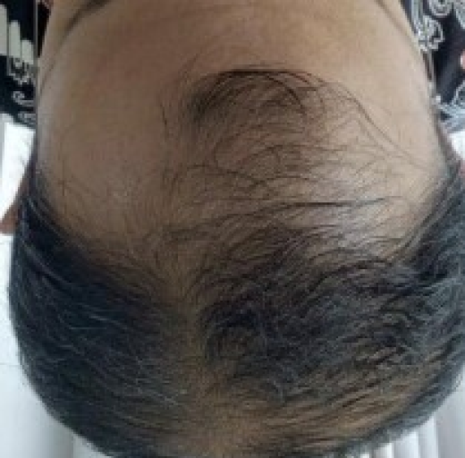 Before/After Image